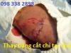 thay băng cắt chỉ